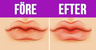 Knep mot torra läppar