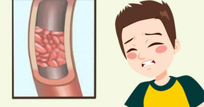c-vitamin, c-vitaminbrist