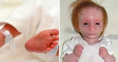 världens minsta flicka