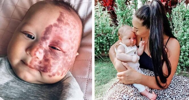 Kingsle, Brook Atkins