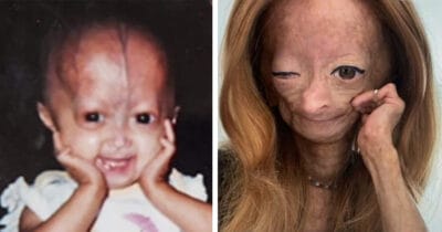 Adalia Rose