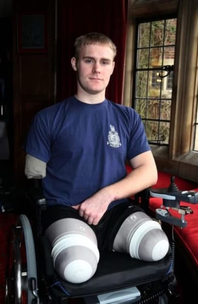 Veteran, krigsveteran, amputera