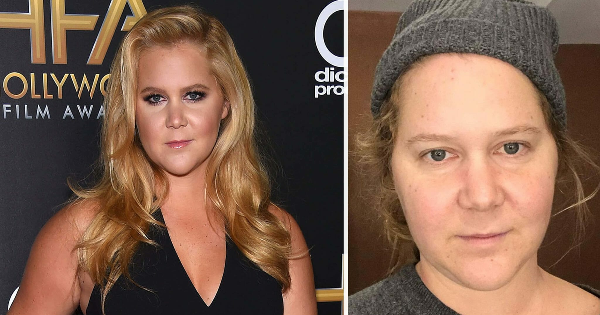 Amy Schumer posts no-makeup selfie, inspires women to embrace a ...